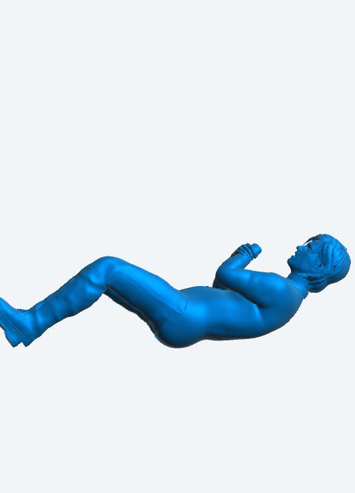 EMS31C Stretcher Patient – Injured Arm